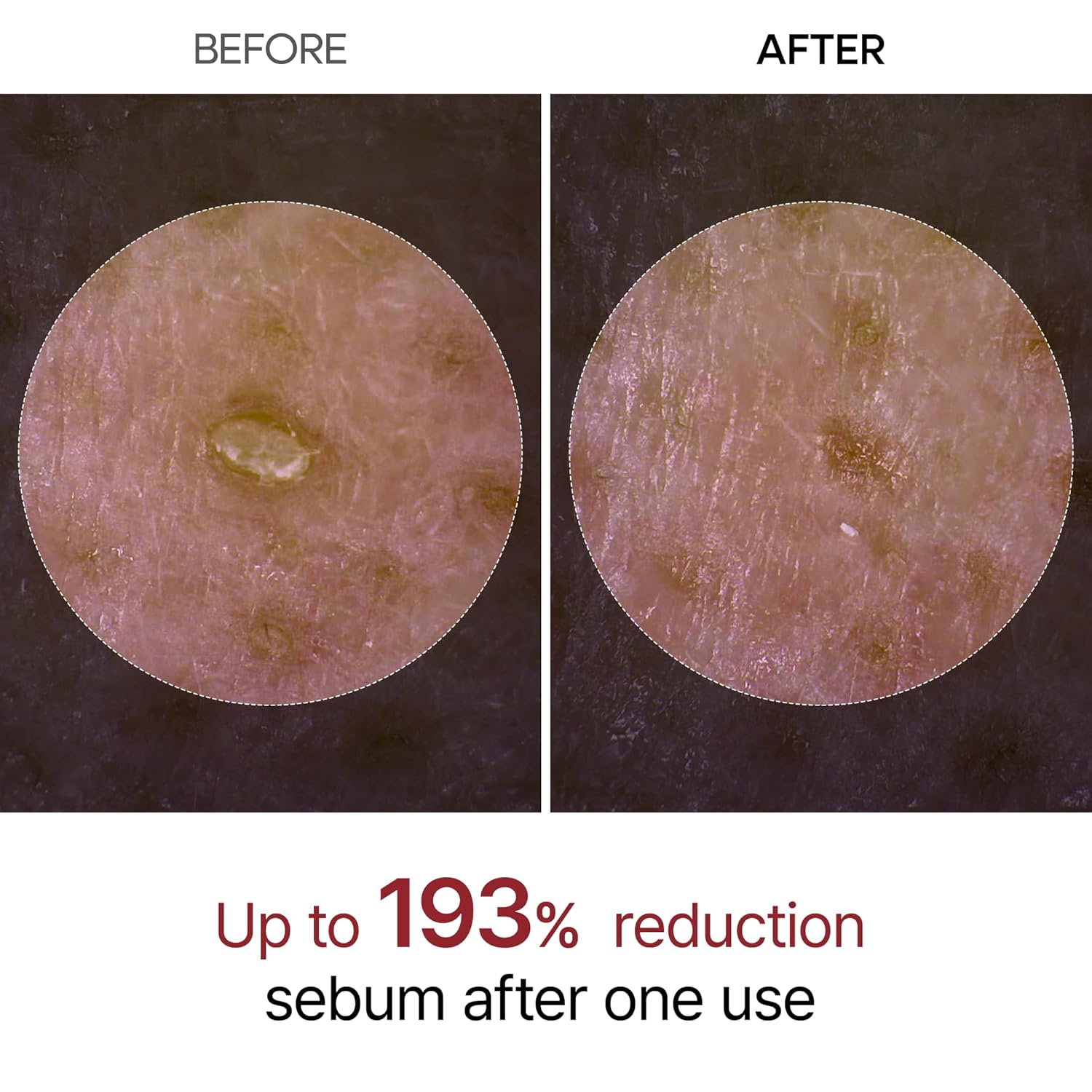 Glow Rice Peel Ampoule Serum