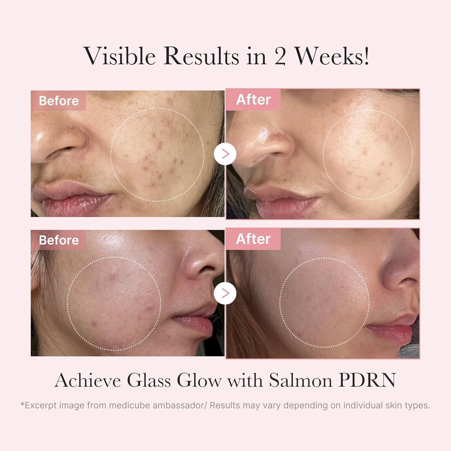 Glass Glow Mini Skincare Set